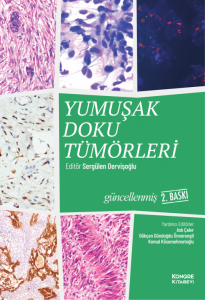 Yumuşak Doku Tümörleri