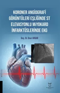 Koroner Angiografi Görüntüleri Eşliğinde ST Elevasyonlu Miyokard İnfarktüslerinde EKG