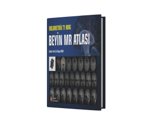 Volumetrik T1 MRG Beyin MR Atlası