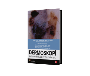 Dermoskopi Kriterlerin Değerlendirilmesi
