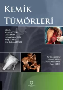 Kemik Tümörleri