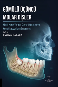 Gömülü Üçüncü Molar Dişler