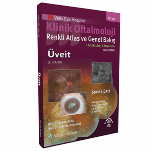 Klinik Oftalmoloji Renkli Atlas ve Genel Bakış - ÜVEİT