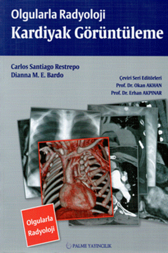Olgularla Radyoloji Toraks Görüntüleme