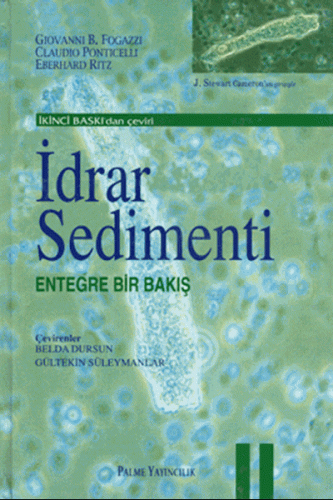 İdrar Sedimenti