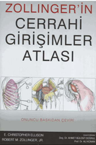 Zollinger'in Cerrahi Girişimler Atlası