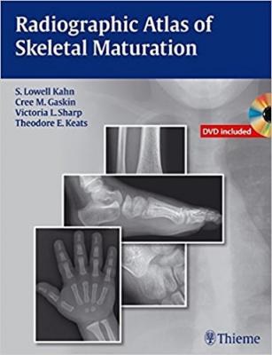 Radiographic Atlas of Skeletal Maturation S. Lowell Kahn