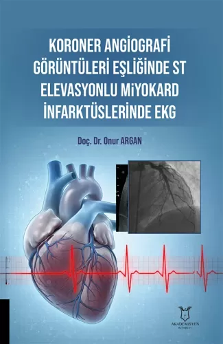 Koroner Angiografi Görüntüleri Eşliğinde ST Elevasyonlu Miyokard İnfarktüslerinde EKG