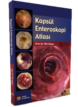 Kapsül Enteroskopi Atlası