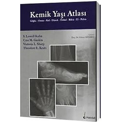 Kemik Yaşı Atlası