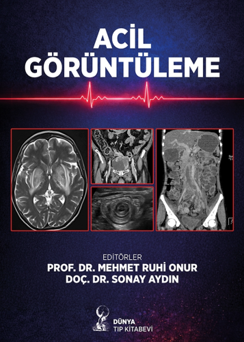 Tıp Kitapları,Radyoloji, - Dünya Tıp Kitabevi - Acil Görüntüleme