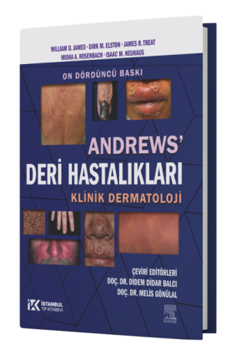 Andrews' Deri Hastalıkları
