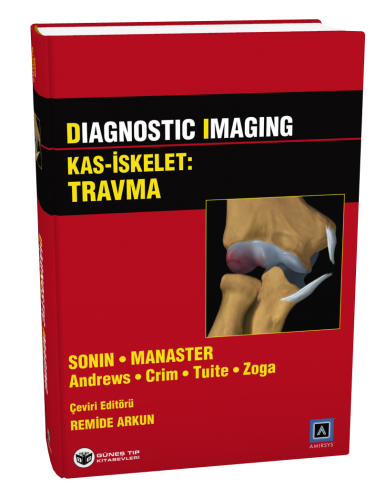 Diagnostic Imaging - Kas İskelet: Travma
