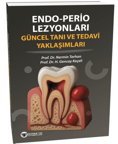 Endo - Perio Lezyonları Güncel Tanı ve Tedavi Yaklaşımları