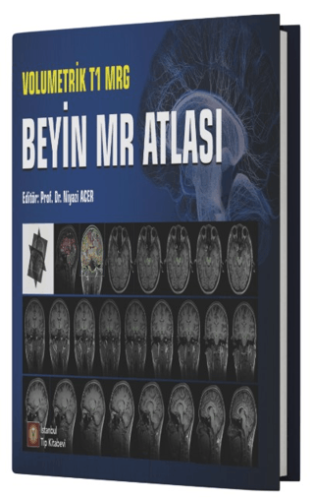Volumetrik T1 MRG Beyin MR Atlası