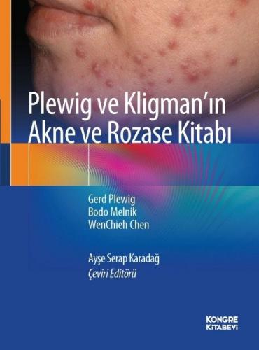 Plewig ve Kligman'ın Akne ve Rozase Kitabı Gerd Plewing