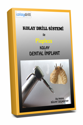 Kolay Drill Sistemi ile Flapless Kolay Dental İmplant Bülent Özçağatay
