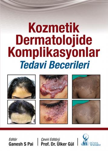 Kozmetik Dermatolojide Komplikasyonlar: Tedavi Becerileri Ganesh S Pai