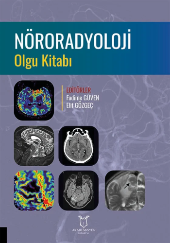 Nöroradyoloji Olgu Kitabı
