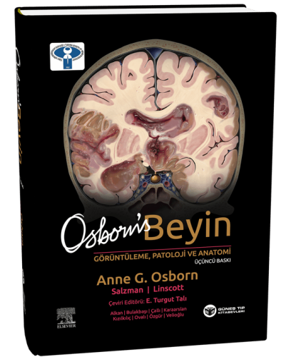 Osborn's Beyin Görüntüleme, Patoloji ve Anatomi