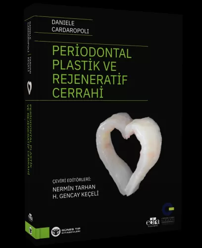 Periodontal Plastik ve Rejeneratif Cerrahi Daniele Cardaropoli
