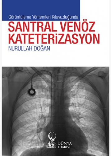 Görüntüleme Yöntemleri Kılavuzluğunda Santral Venöz Kateterizasyon