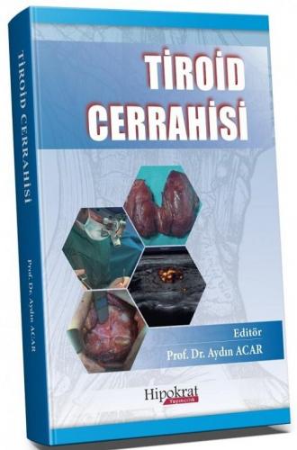 Tiroid Cerrahisi Aydın Acar