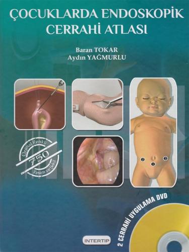 Çocuklarda Endoskopik Cerrahi Atlası