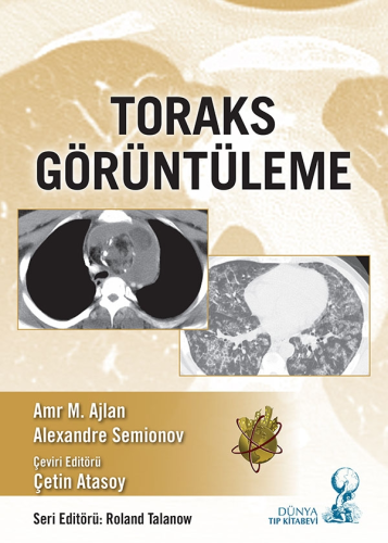 Toraks Görüntüleme